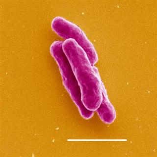 [culosis+mycobacterium.jpg]