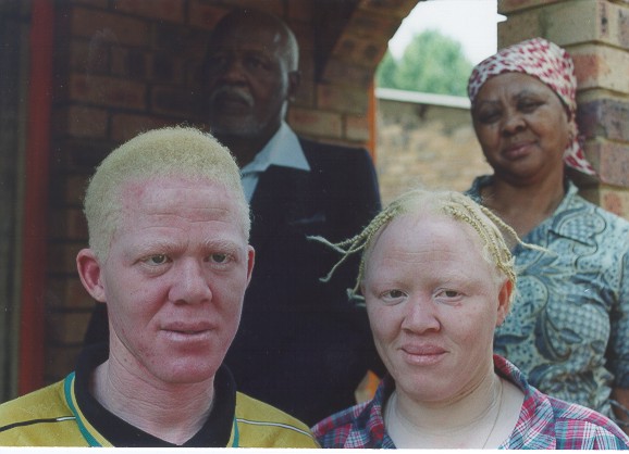 [negros-albinos.jpg]