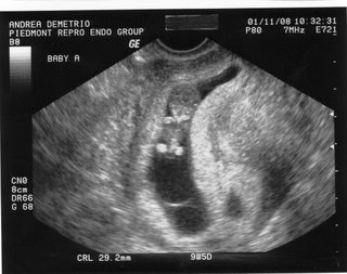 [01.11+-+Ultrasound+Baby+A+1.jpg]