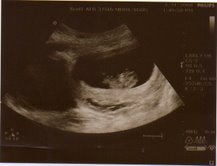 [03.31.08.ultrasound.jpg]