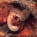 [250px-Tubal_Pregnancy_with_embryo.gif.jpg]