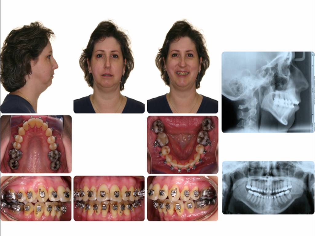 [copy+preop+orthodontic+pics.jpg]