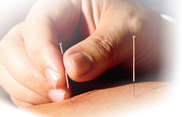 [Acne-Treatment-Acupuncture.jpg]