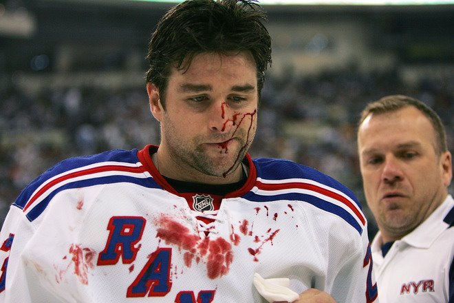 Chris Drury bleeding after getting a stick in the face from the Pens Ryan Malone