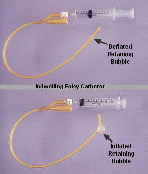 [Foley+Catheter+1+Blog.jpg]