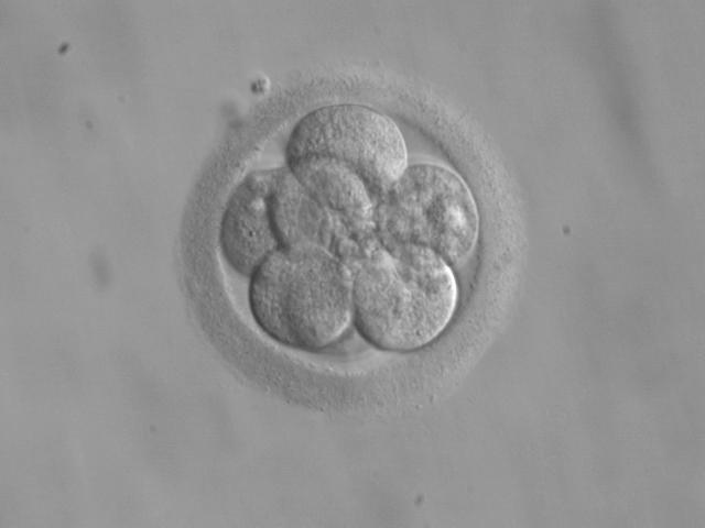 [Embryo,.jpg]