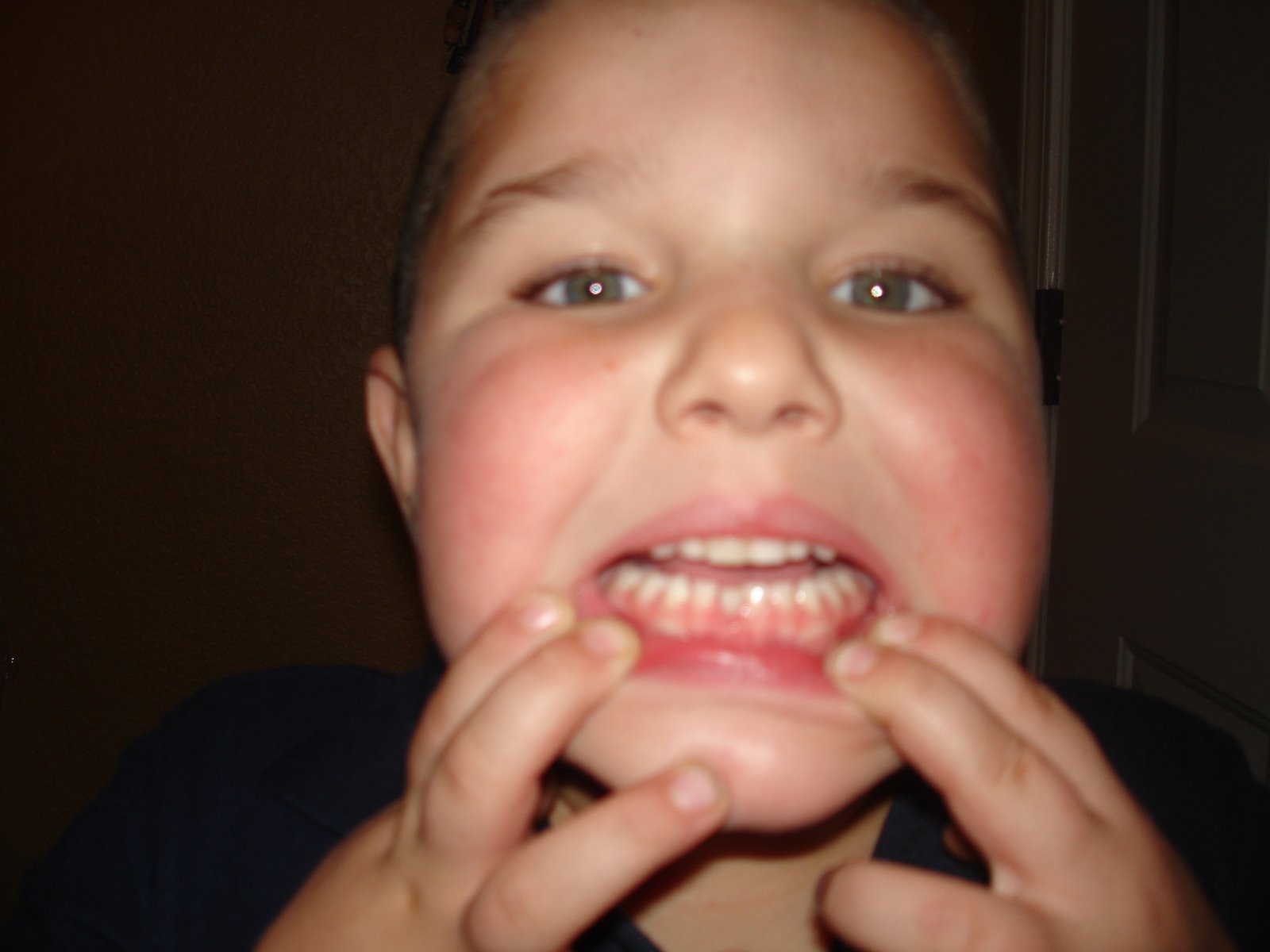 [Caleb's+first+tooth+loss+008.jpg]