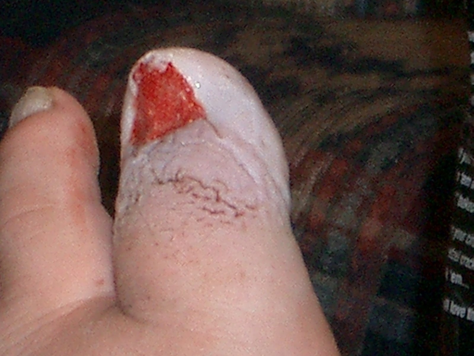 [Toe+After+2.JPG]