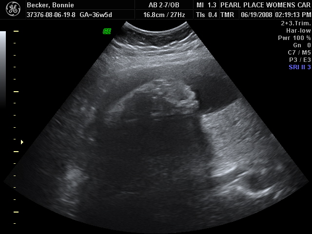 [2008_06_19_ultrasound4.JPG]