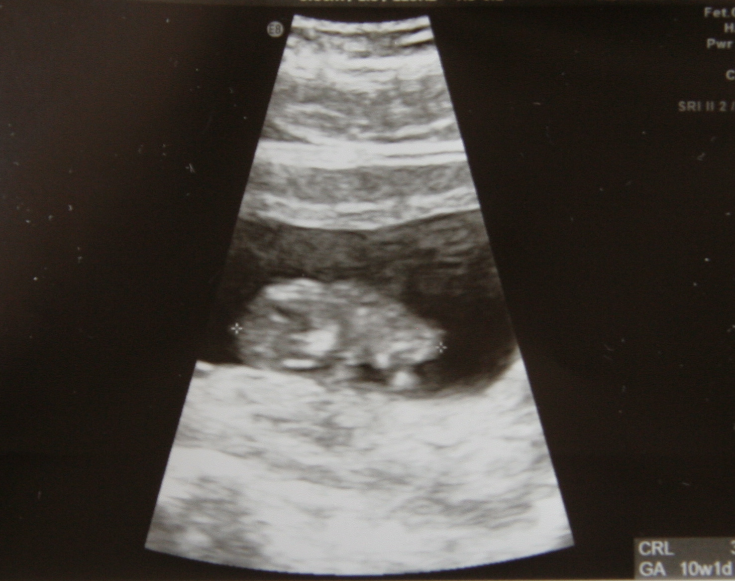 [ultrasound.jpg]