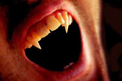 [1-vampiro-dentes-presas.jpg]