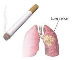 [smoking-causes-lung-cancer.jpg]