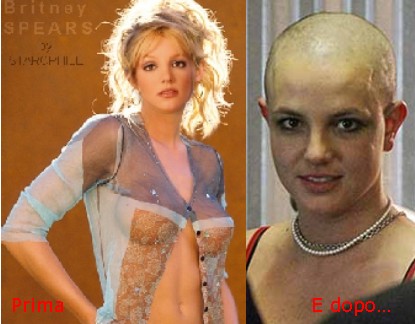 [Britney+prima+e+dopo.jpg]