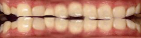 [teeth.jpg]