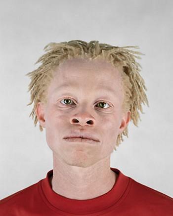 [albino-africans02.jpg]