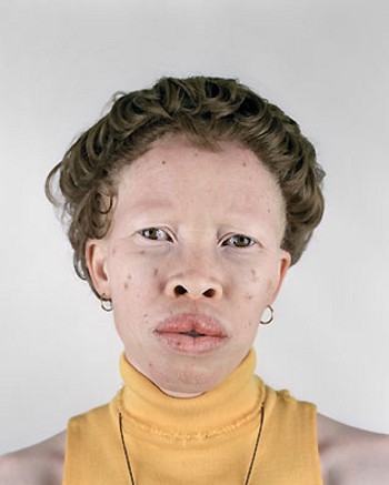 [albino-africans07.jpg]