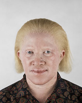 [albino-africans09.jpg]