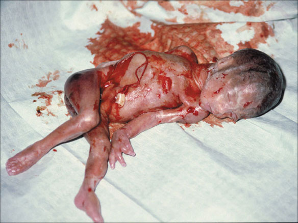 [abortion-22-01.jpg]