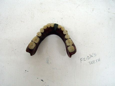 [frida's+teeth.jpg]