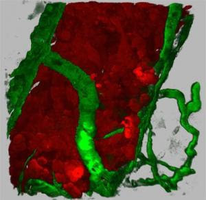 human tumor cells inducing angiogenesis within the Zebrafish body wall